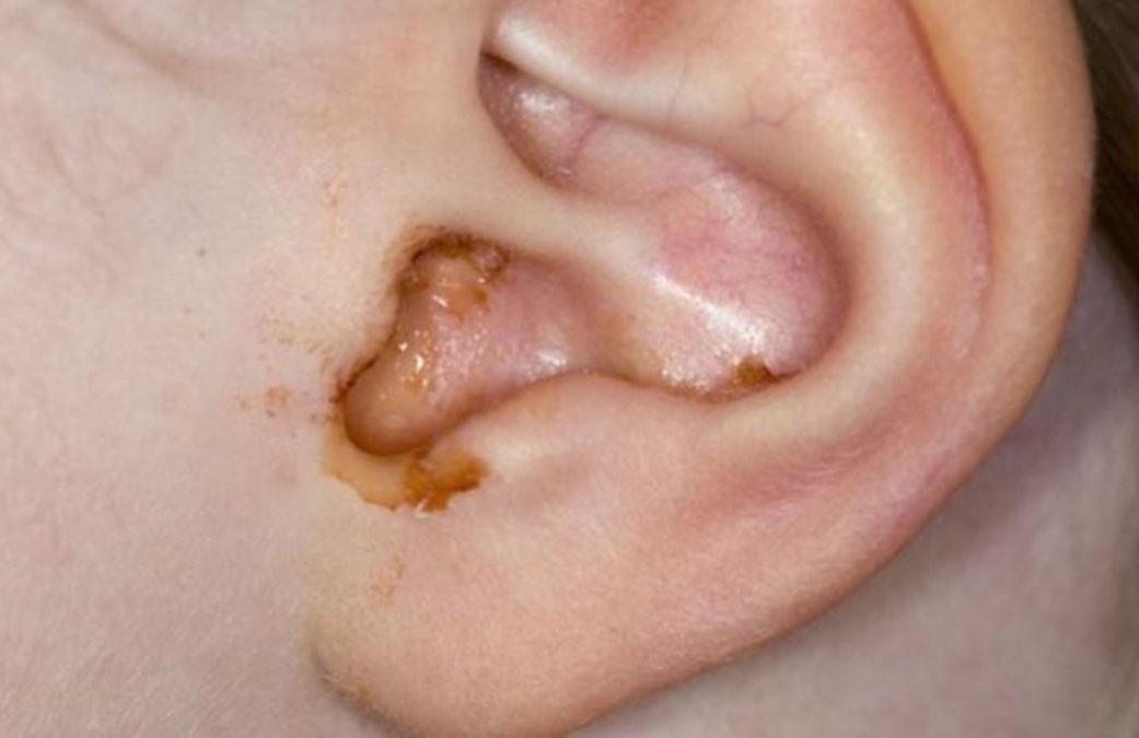 Ear 1.jpg